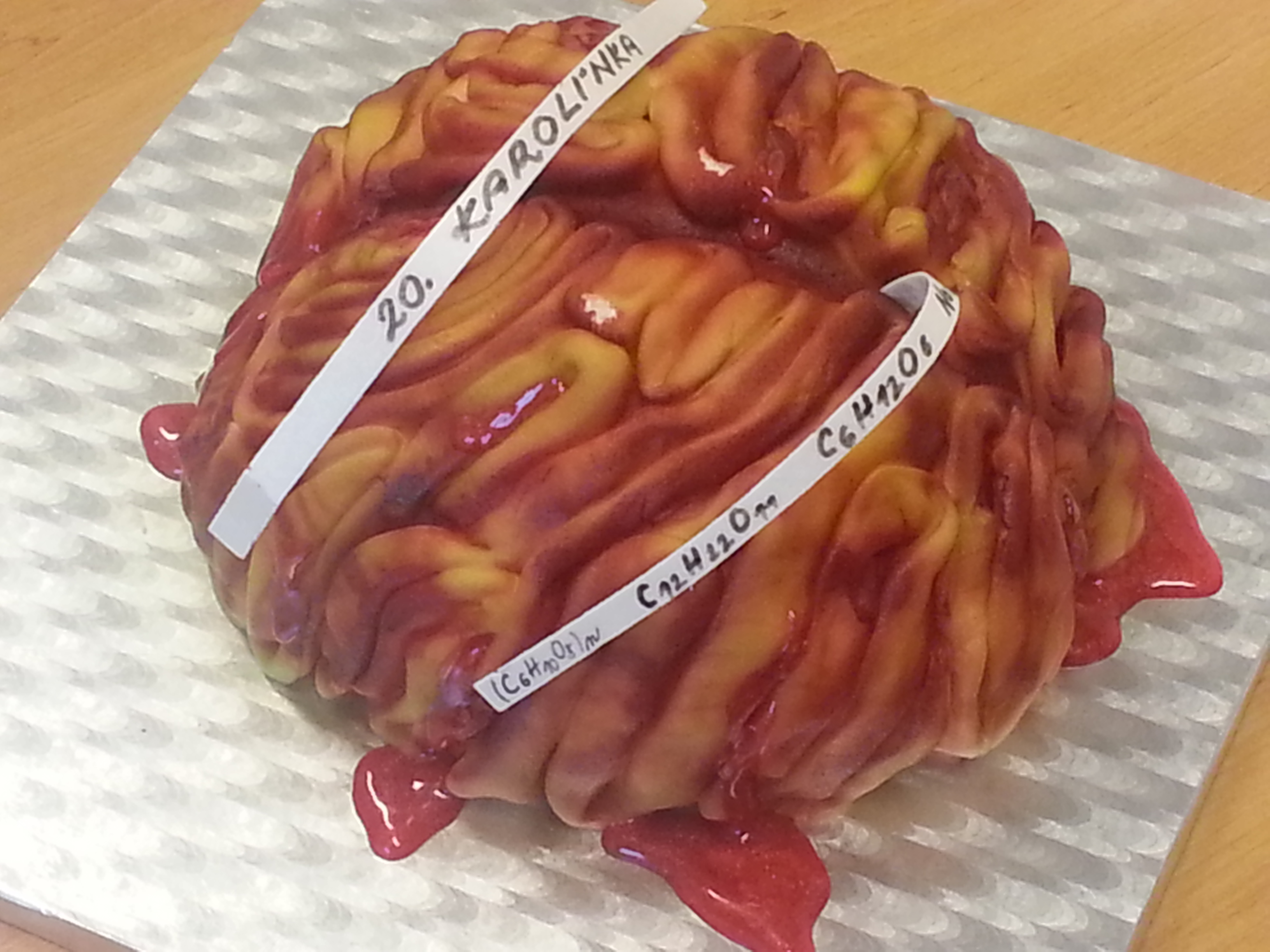 mozek 2200 g